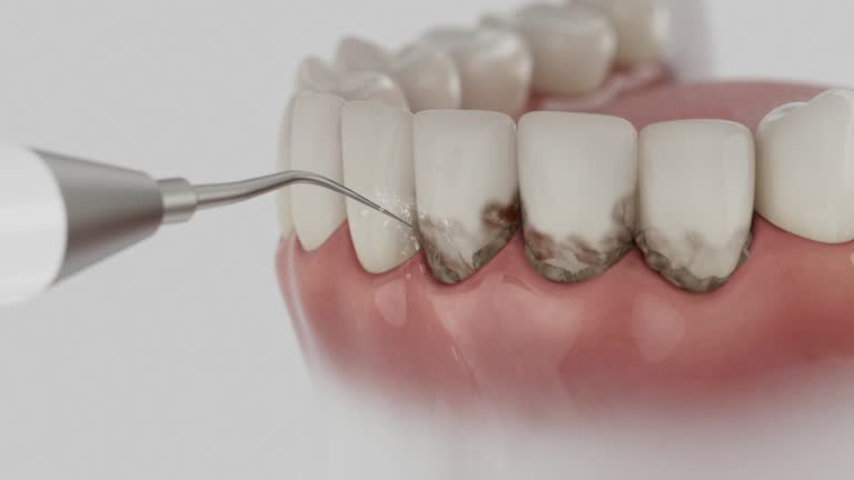 Reliable Dental Implants contractor in Columbus AFB, MS by Smile Center Dentistry